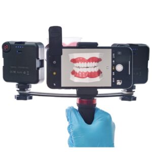 کیت نور دوقلوی دندانپزشکی موبایل اوسینو/ Osino Dental light